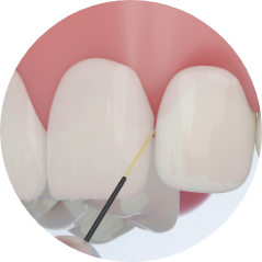 歯周病治療 PERIODONTAL